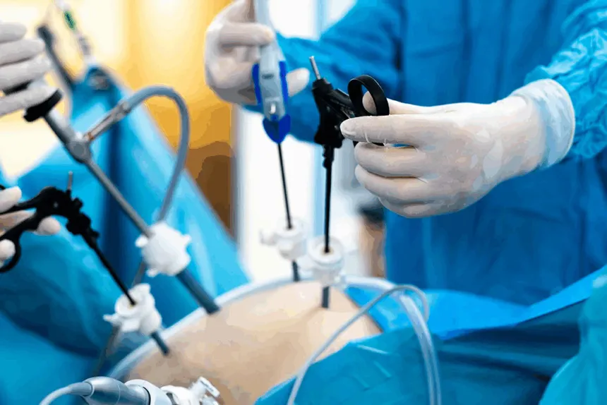 Laparoscopic Surgery